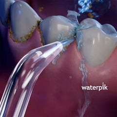 Classic Tip (fits Classic water flossers only)